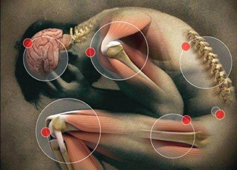 Instrumentación utilizada para evaluar el dolor en intervenciones osteopáticas: una revisión sistemática