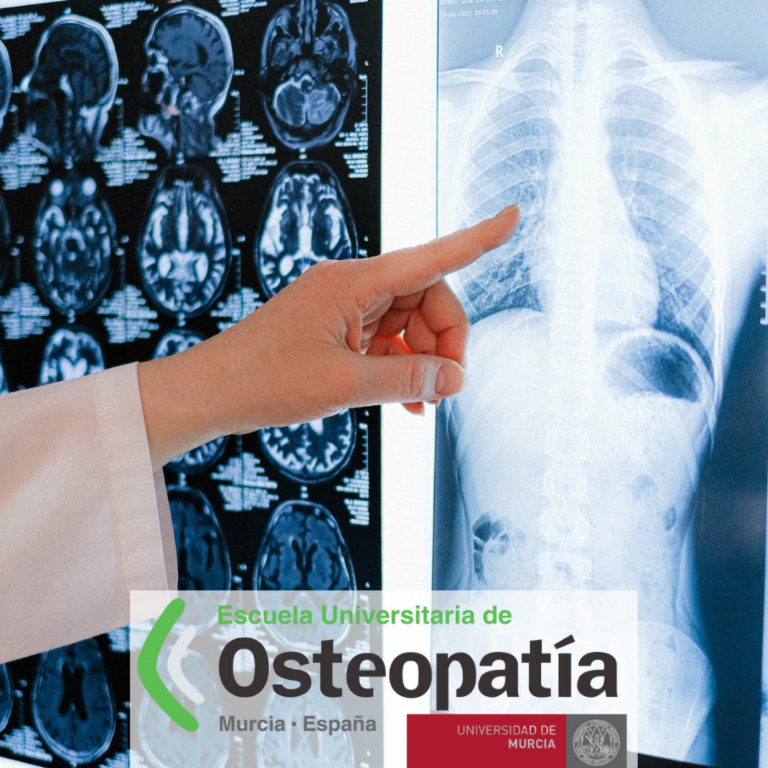 Efectos de la manipulación osteopática y otros tratamientos de manipulación manual sobre la fibrosis quística.